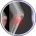 joint treatment knee pain