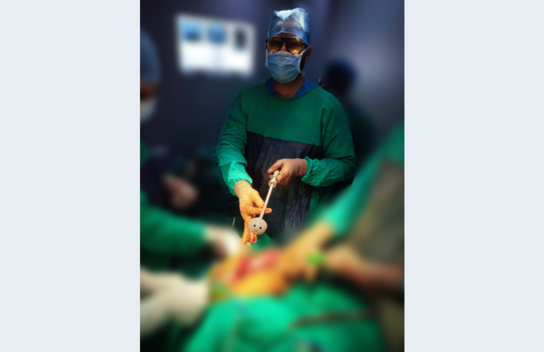 Ilizarov Surgery and Deformity Correction in Indore