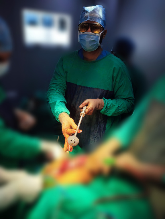 Dr. Anupam Khandelwal, Joint replacement Surgeon, Indore performing Hip replacement surgery in operation theatre showing Acetabular cup