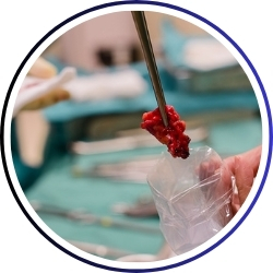 Cancer Specialist(कैंसर विशेषज्ञ)