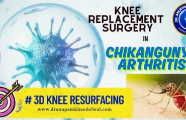 KNEE REPLACEMENT IN CHIKANGUNYA ARTHRITIS , INDORE, DR. ANUPAM KHANDELWAL,Best orthopedic surgeon ,best knee replacement indore, best hip replacement indore.