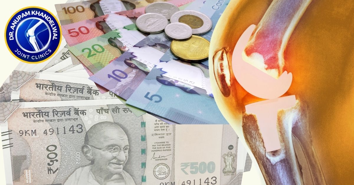 cost of knee replacement surgery - Dr. Anupam khandelwal