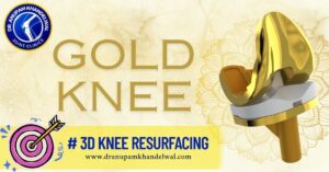 ✨ Gold Knee Resurfacing in Indore – A Success Story by Dr. Anupam Khandelwal