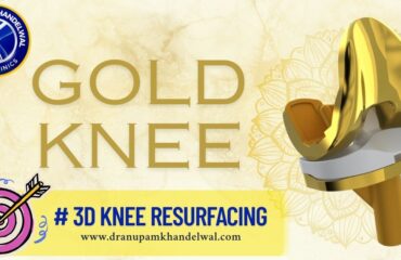 gold knee replacement indore - Dr. Anupam Khandelwal