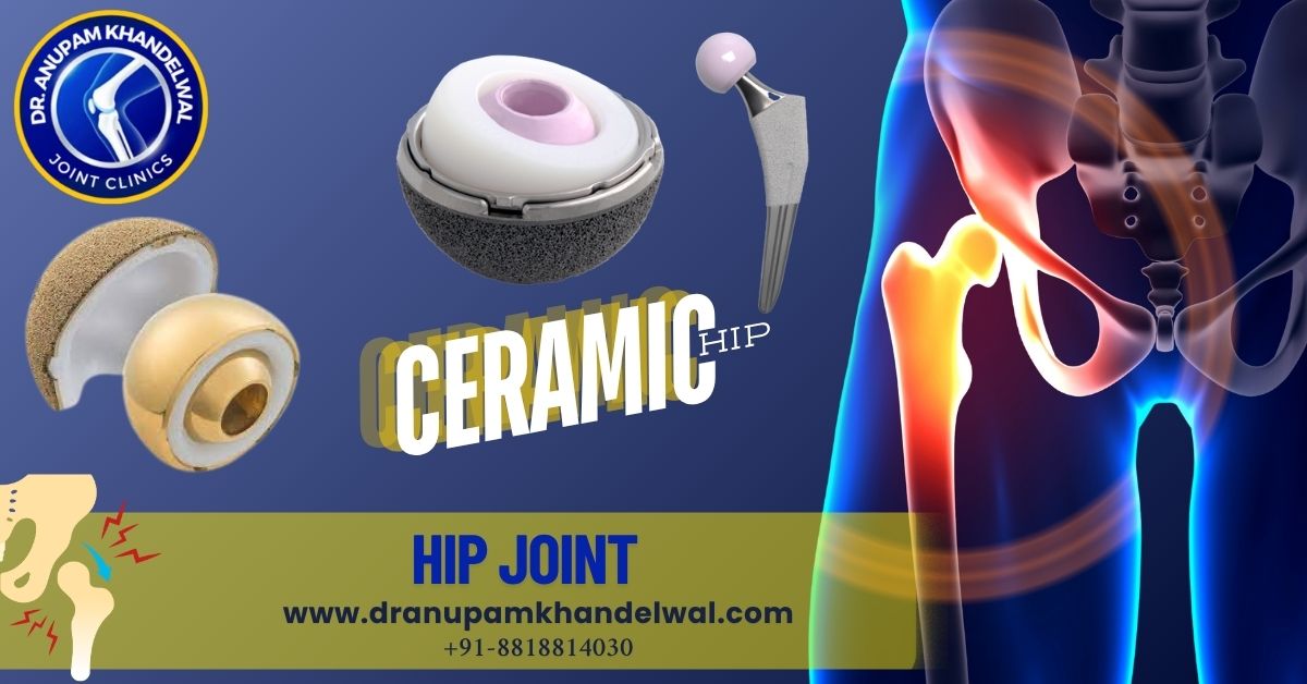 Dr. Anupam Khandelwal - HIP joint - कूल्हे का जोड़ - ceramic & Dual mobility hip implant