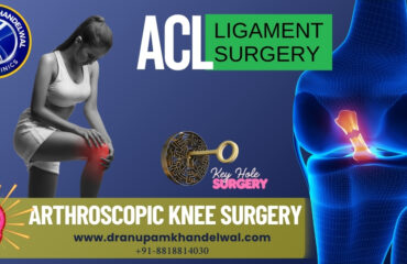 Dr. Anupam Khandelwal - acl Knee ligament surgery by KEy Hole Arthroscopic surgery technique in Indore/Bhopal/Ujjain/Ratlam