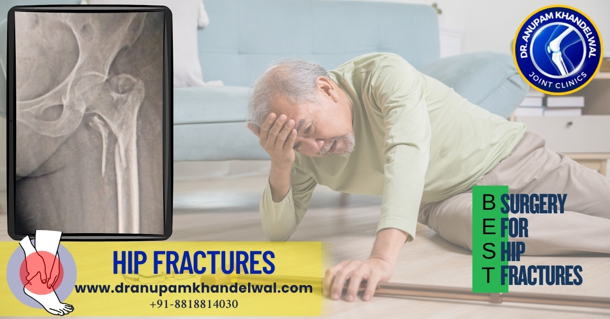 Best surgery for Hip fractures - Dr. Anupam Khandelwal, Indore,Best orthopedic surgeon ,best knee replacement indore, best hip replacement indore.