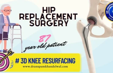 hip replacement surgery at 87 year old patient-Dr. Anupam Khandelwal,Best orthopedic surgeon ,best knee replacement indore, best hip replacement indore.