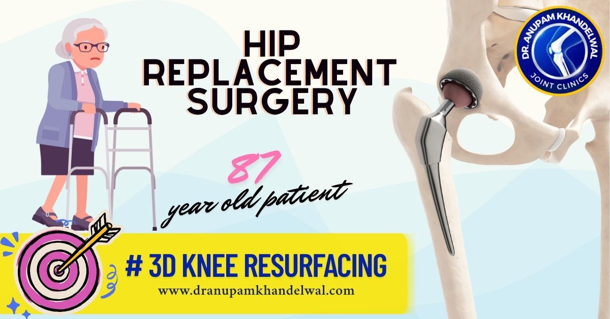 hip replacement surgery at 87 year old patient-Dr. Anupam Khandelwal,Best orthopedic surgeon ,best knee replacement indore, best hip replacement indore.