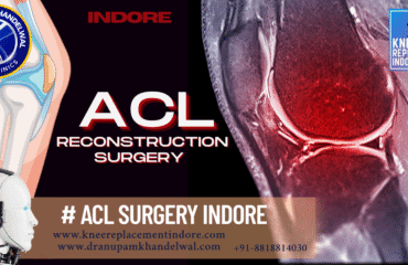 Best ACL Reconstruction Surgery in Indore-Dr Anupam khandelwal,Best orthopedic surgeon in indore ,best knee replacement indore, best hip replacement indore.