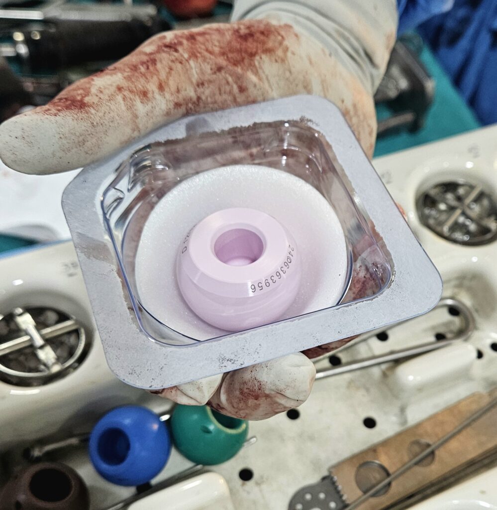 Benefits of Using Ceramic Head in Total Hip Replacement – Dr. Anupam Khandelwal, Indore