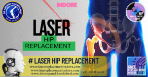 Laser Hip Replacement: Advanced Technology for a Pain-Free Life