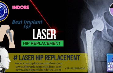 Best Implants for Laser Hip Replacement Surgery in Indore -Dr. Anupam Khandelwal,Best orthopedic surgeon in indore ,best knee replacement indore, best hip replacement indore.