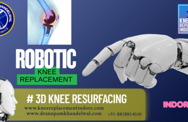 Why Choose Robotic Knee Replacement in Indore? Benefits, Cost & Recovery Explained-Dr. Anupam Khandelwal,Best orthopedic surgeon in indore ,best knee replacement indore, best hip replacement indore.