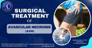 Surgical Treatment of AVN: Advanced Care in Indore