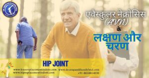 Symptoms & Stages of Avascular Necrosis (AVN) – Treatment in Indore