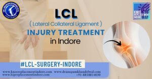 LCL Treatment in Indore – Expert Knee Care