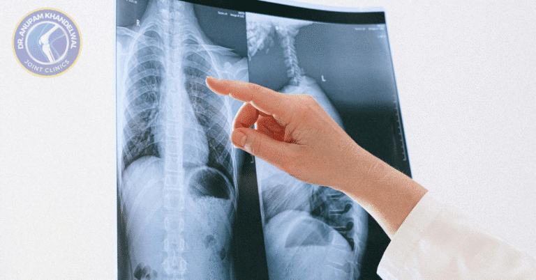 Knee joint X-ray showing bone alignment and joint space used for accurate orthopedic diagnosis