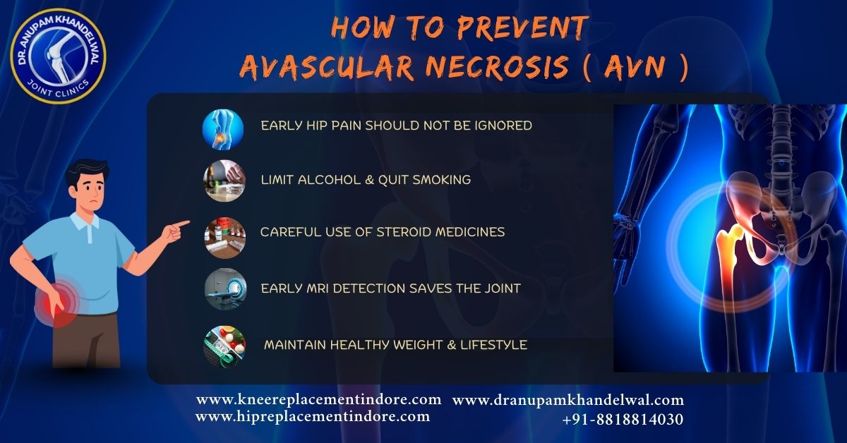 How to prevent Avascular Necrosis (AVN).