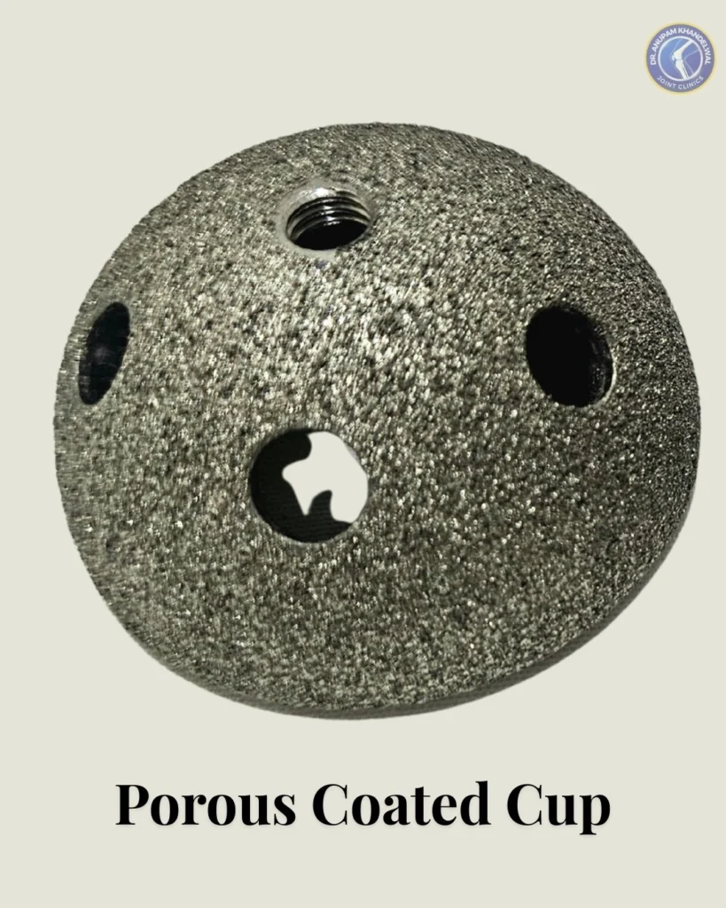 Porous Coated Acetabular Cup Implant with porous surface for bone ingrowth, used in Hip Replacement Surgery as one of the आधुनिक हिप रिप्लेसमेंट इम्प्लांट के प्रकार.