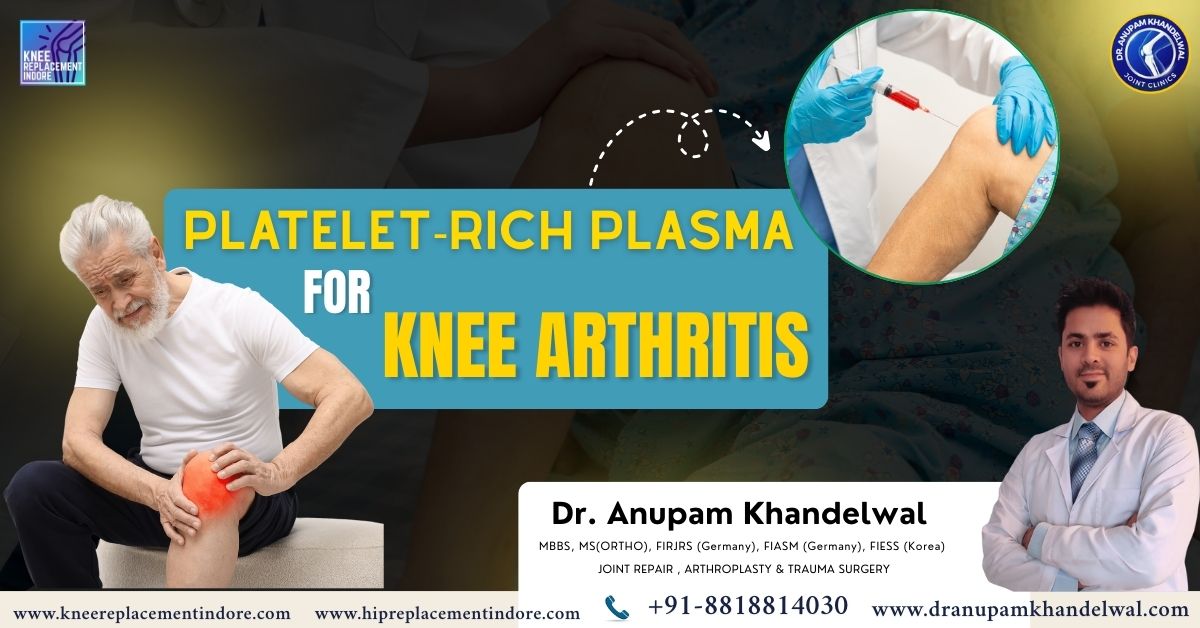 PRP injection for knee pain performed as part of PRP in Early Knee Arthritis Indore treatment by orthopedic specialist Dr. Anupam Khandelwal