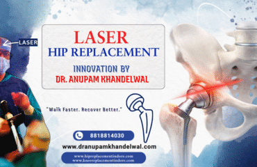 Laser Hip Replacement in India by Dr Anupam Khandelwal showing precision implant alignment using laser technique in Indore