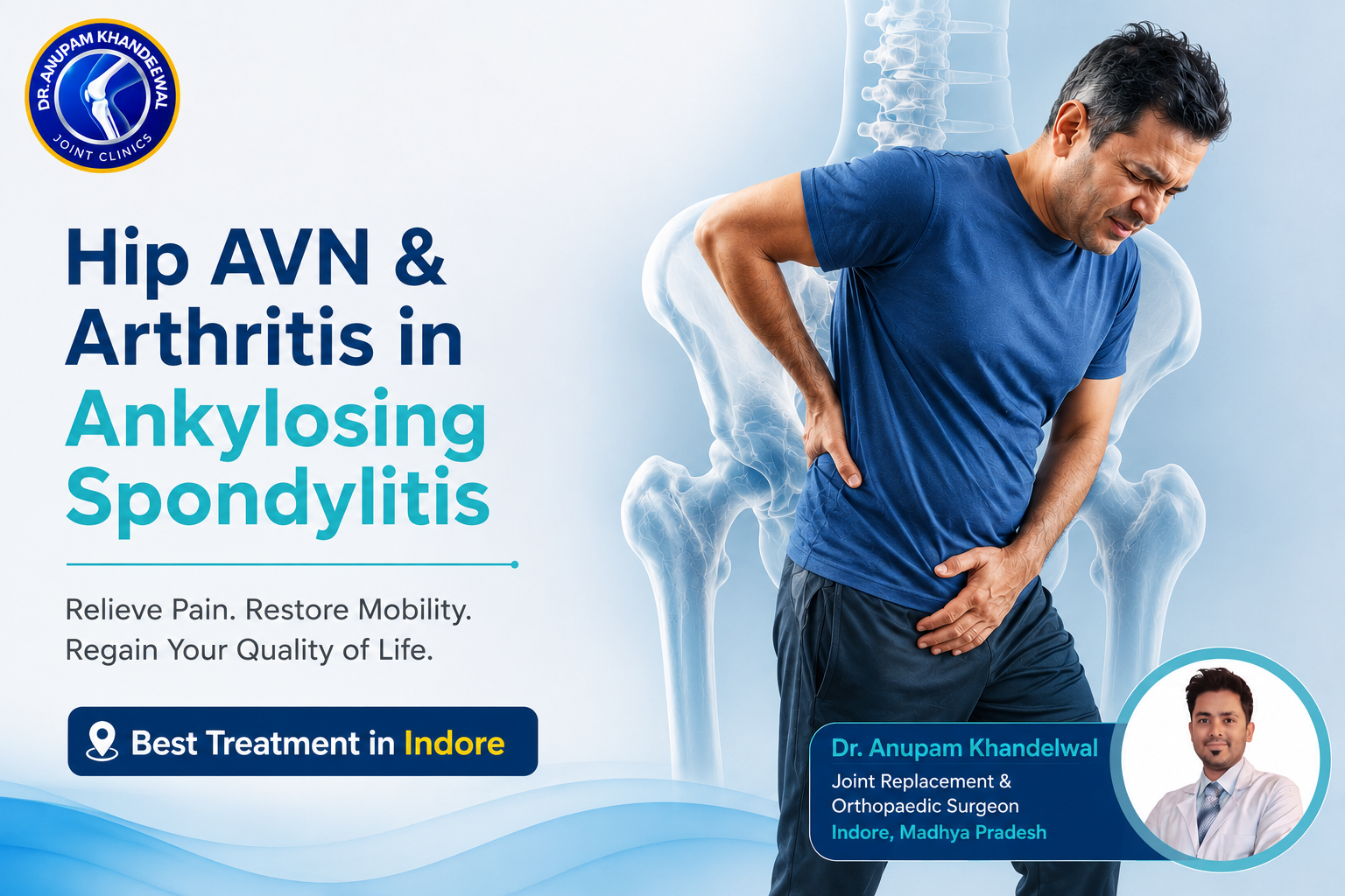 Medical illustration showing Hip AVN and hip arthritis in Ankylosing Spondylitis with inflamed hip joints, cartilage damage, and reduced mobility.