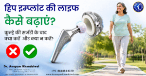 हिप सर्जरी के बाद की सावधानियां: हिप इम्प्लांट की लाइफ कैसे बढ़ाएं?