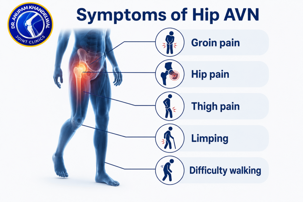 Medical illustration showing the common symptoms of hip pain, groin pain, limping, and stiffness caused by Avascular Necrosis in Sickle Cell Disease.