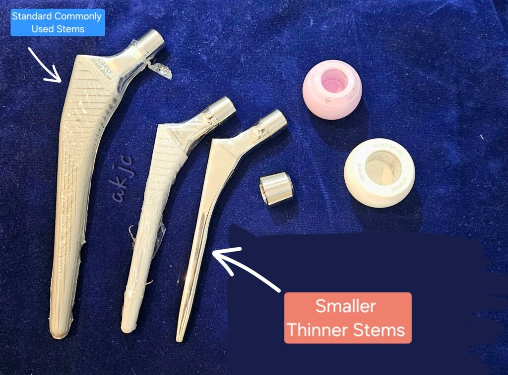 Small and thin femoral stem implant used for patients with narrow femoral canals and complex hip anatomy