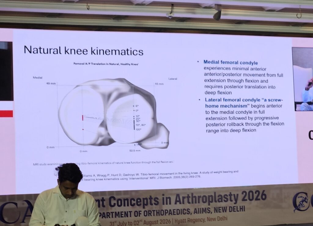 Kinematic alignment principles discussed at Current Concepts in Arthroplasty (CCA) 2026 AIIMS New Delhi during a session on robotic knee replacement surgery and natural knee kinematics.